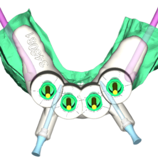 Surgical Guides