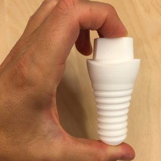 3D Printed Large Replica of CeraRoot implant